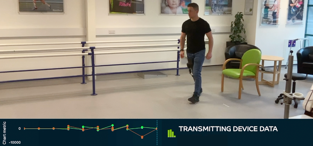 Smartstep allows you review video in sync with the recorded data from the Blatchford prosthetic device