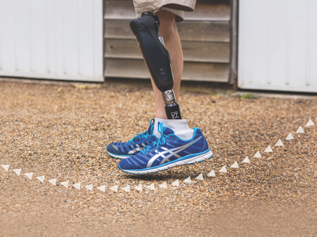 Blatchford Prosthetic Technology