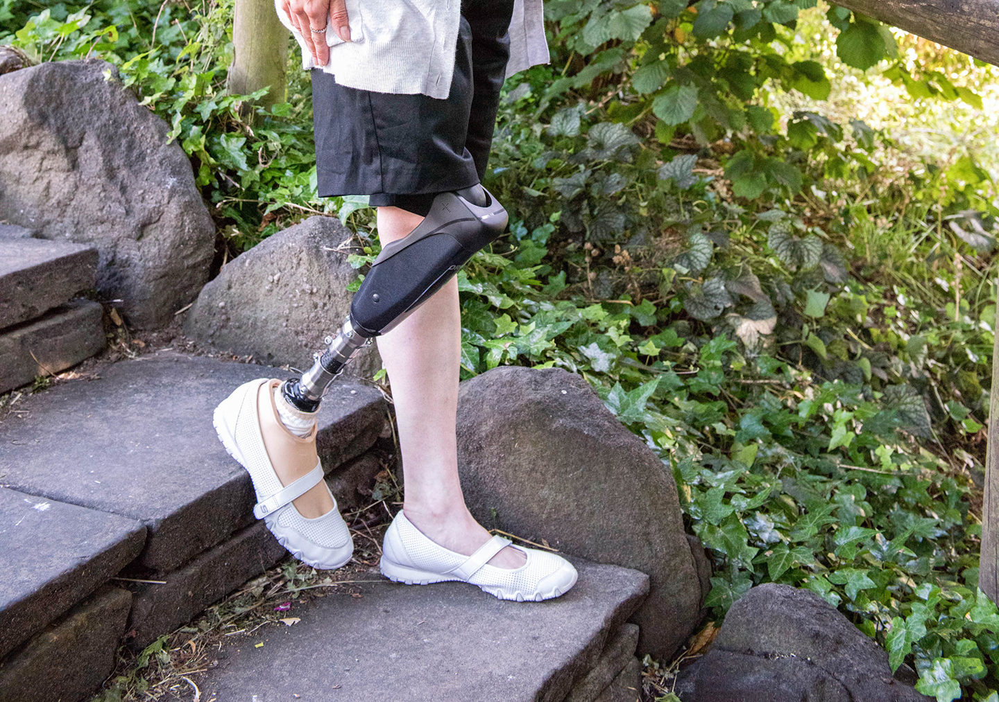 Becky2 Above Knee For Umbraco